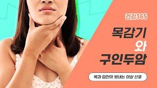 목과 입안이 보내는 이상 신호, 목감기와 구인두암 [TBC클리닉건강365] [TBC-띠비띠]