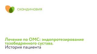 Лечение по ОМС: эндопротезирование тазобедренного сустава. История пациента.