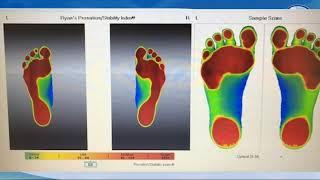 CPOYA Webinar 82: 5-28-2019 | 15 Year Old Soccer Player with Severe Groin Pain for 6 Months