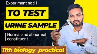 To test urine sample for normal and abnormal constituents #class11thbiology