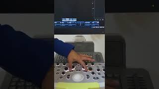 Mindray Ultrasound Machine Demo