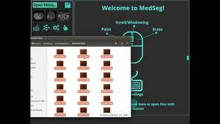 Converting DICOM to nifti in the web-browser