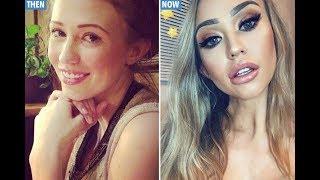 Big Brother 10 winner Sophie Reade looks totally different after having lip fillers