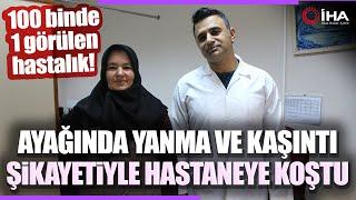 Ayağında Yanma ve Kaşıntıdan Hastaneye Başvurdu 100 Binde 1 Görülüyor!