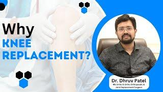 Why Knee Replacement? | Benefits & When to Consider Knee Surgery | Dr.Dhruv Patel