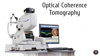 Optical Coherence Tomography | Biomedical Engineers TV |