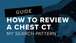 How to Review a Chest CT: My Search Pattern