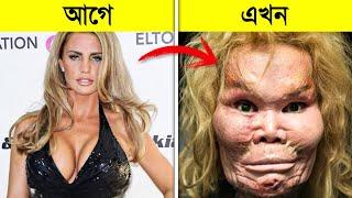 দেখুন প্লাস্টিক সার্জারি কতটা ভয়ংকর..!  || The Dark Truth of Plastic Surgery