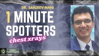 XRAY CHEST SPOTTERS | DR SANJEEV MANI | Quick Viewing of Exam Chest Spotters for MD & MBBS Students