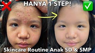 Skincare Routine Untuk Menghilangkan Jerawat Anak SD & SMP || Christina Immanuel