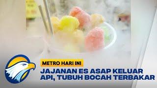 Jajanan Es Asap Keluar Api, Tubuh Bocah 5 Tahun Terbakar