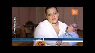 В  Одессе живёт единственный в мире малыш без черепа