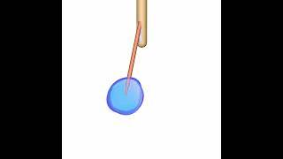 Radially Branching Cellular Delivery Device for Use in OR Fluoroscopy/CT Guidance & MRI