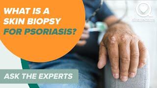 Symptoms and Causes for Psoriasis | Ask The Experts | Sharecare