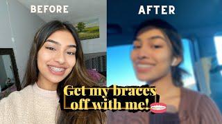 GETTING MY BRACES OFF  *finally*