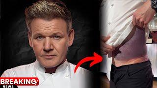 Gordon Ramsay Almost Died!