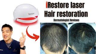 iRestore laser hair restoration| Dermatologist Reviews