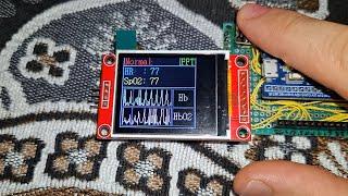 STM32 HEART RATE MONITOR MAX30100 STM32F103 ST7735