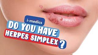 Do You Have Herpes Simplex? (60 second health check)‍️🩺