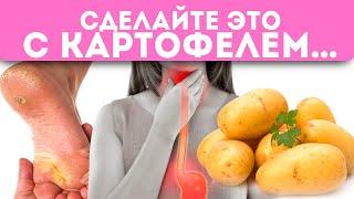 Вытягивает как клещи всю гадость из организма! Картофель от отеков, геморроя, язвы …