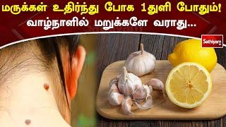 மருக்கள் உதிர்ந்து போக 1துளி  போதும்!!!வாழ்நாளில் மறுக்களே வராது | Web Special | SathiyamTV