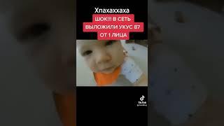 УКУС 87 В РЕАЛЬНОЙ ЖИЗНИ