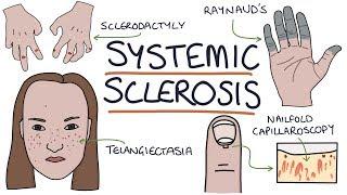 Systemic Sclerosis and Scleroderma: Visual Explanation for Students