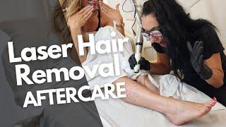 Essential Aftercare Tips: What to Do After Your Laser Hair Removal Appointment