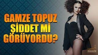 Gamze Topuz - Tümer Metin İlişkisini Şiddet mi Bitirdi?