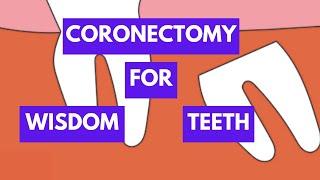 Coronectomy - Alternative Method to Remove Impacted Mandibular Third Molars