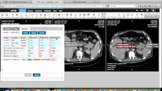 ePAD: Quantitative Imaging in the Routine Clinical Workflow