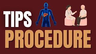 Supercharge Your Liver with TIPS (Transjugular Intrahepatic Portosystemic Shunt)