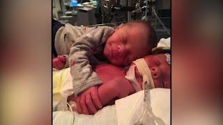 Photo of newborn twins hugging goes viral