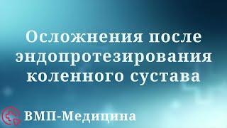 Осложнения после эндопротезирования коленного сустава | ВМП-Медицина