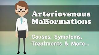 Arteriovenous Malformations - Causes, Symptoms, Treatments & More…