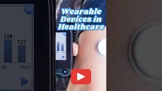 How Wearable Devices Are Revolutionizing Healthcare with IoT