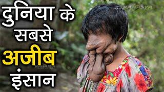 Top 10 strangest people in the world who don't seem to be from this world \ Amazing facts in Hindi \ Rahasya