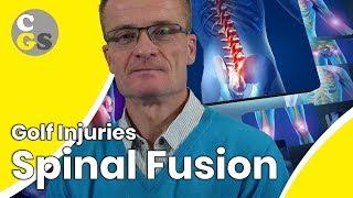 Golf Injuries - Spinal Fusion - MD Dietmar Göbel | CONSISTENCY GOLF SWING