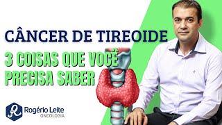 3 Coisas sobre o câncer de tireoide- Dr. Rogério Leite