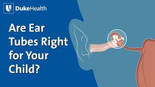 Does Your Child Need Ear Tubes? | Duke Health