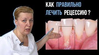 Оголяются корни зубов. Рецессия десны.