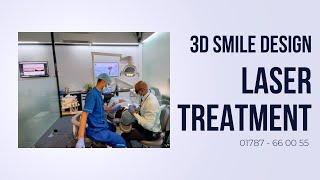 3D Smile Design | Laser Treatment