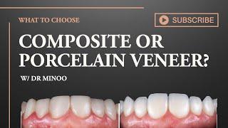 Which is better? Porcelain or Composite veneers?