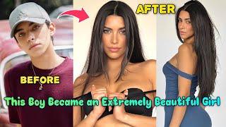 Male to Female Sex Change That Will Blow Your Mind | Boy to Girl Transition | MTF Transition