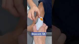 Dexcom G6 мониторинг сахара #dexcomg6 #мониторингглюкозы #диабет #диабетудетей