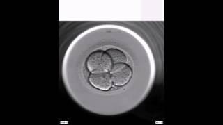 Embryoscope - Centro Raprui