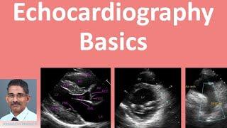 Echocardiography Basics