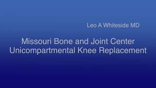 Missouri Bone and Joint Center unicompartmental knee replacement Leo Whiteside