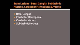 Brain Lesions - Basal Ganglia, Subthalmic Nucleus, Cerebellar Hemisphere & Vermis