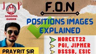 FON- POSITIONS IMAGES DETAILED VIDEO #norcet2022 #nursingofficer #aiims #jpnursingguider #dsssb